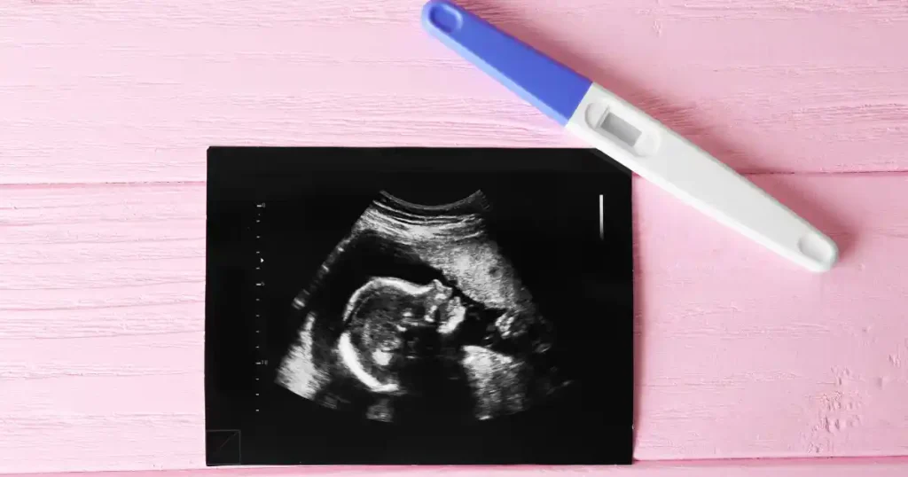 Best Ovulation Calculator for PCOS and Fertility Tracking